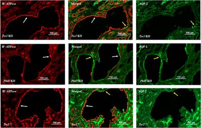 Not all kidney cysts are created equal: a distinct renal cystogenic mechanism in tuberous sclerosis complex (TSC)